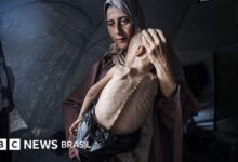Fome em Gaza: a história por trás da chocante foto do bebê palestino faminto