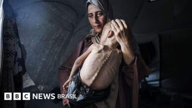 Fome em Gaza: a história por trás da chocante foto do bebê palestino faminto