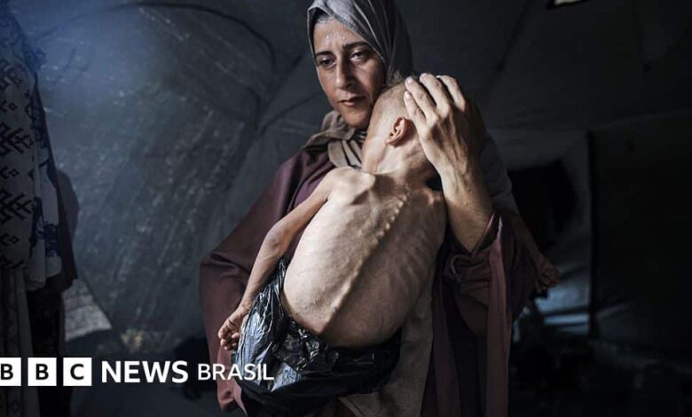 Fome em Gaza: a história por trás da chocante foto do bebê palestino faminto