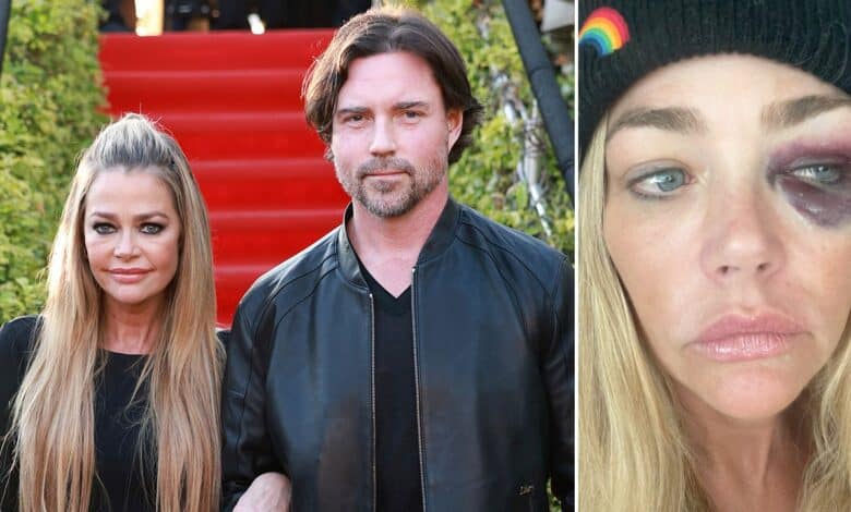 Denise Richards granted restraining order against husband amid abuse claims