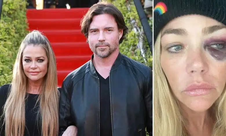 Denise Richards granted restraining order against husband amid abuse claims