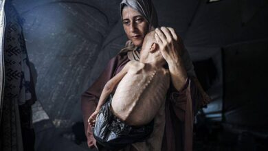 A imagem mostra uma mulher com um lenço na cabeça segurando uma criança magra em seus braços. A criança parece estar em estado de desnutrição, com o corpo visivelmente esquelético. O ambiente ao redor é de uma tenda, com luz suave entrando por uma abertura. A expressão da mulher é de preocupação e tristeza.