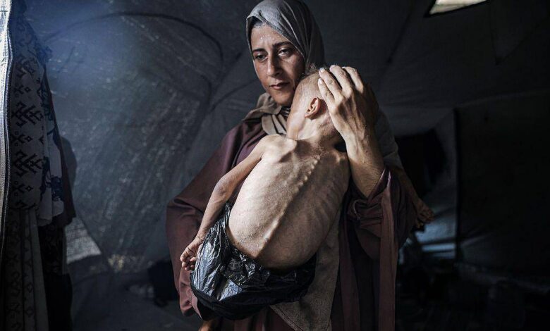 A imagem mostra uma mulher com um lenço na cabeça segurando uma criança magra em seus braços. A criança parece estar em estado de desnutrição, com o corpo visivelmente esquelético. O ambiente ao redor é de uma tenda, com luz suave entrando por uma abertura. A expressão da mulher é de preocupação e tristeza.