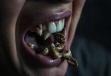sonhar com dentes podres caindo