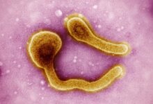 Etiópia vive surto de Marburg, primo mais letal do Ebola