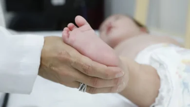Atraso no teste do pezinho no SUS agrava diagnóstico da AME